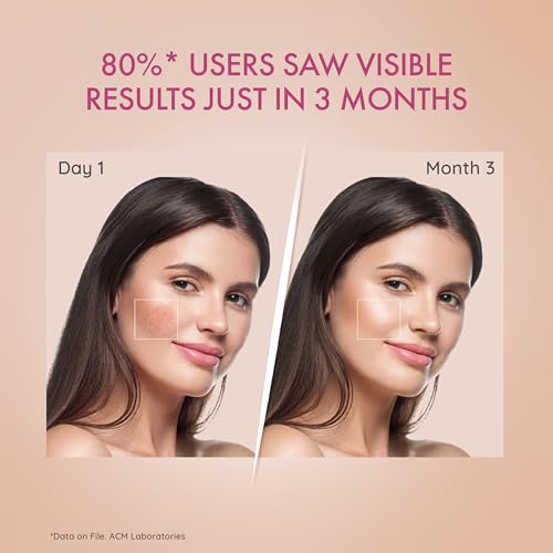 Dr. Reddy’s Depiwhite Advanced Cream, enriched with 2% Vitamin C, 1% Niacinamide & 2% Kojic Acid | Dermatologist recommended| Men & Women| suits all skin types|15ml