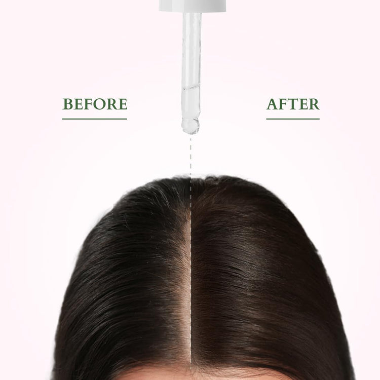 Lotus Organics+ Hair Growth Active Concentrate Serum | Made with 100% Organic Rosemary Oil, AnaGain & Hairdian | Boosts Hair Growth | Increases Thickness | Strengthens Hair Follicles | For All Hair Types | 28ml
