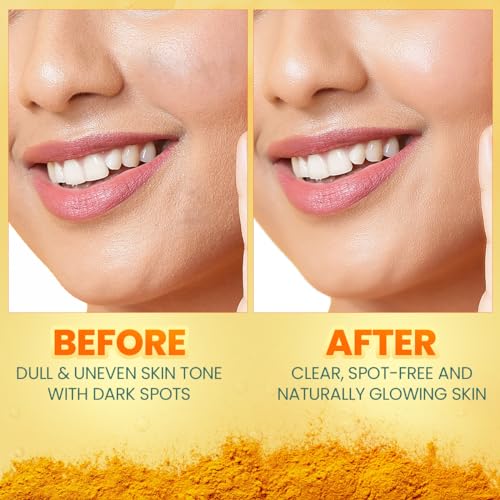 Himalaya Dark Spot Clearing Turmeric Face Serum | 10% Glycolic Acid & 2% Niacinamide | Organically sourced Turmeric | Reduce dark spots in 7 days | 30ml