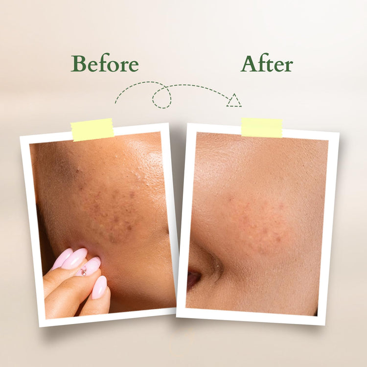 Lotus Organics+ Vitamin - C Radiance Booster Cleanser | 100% Certified Organic Lemon Verbena | Removes Dirt & Excess Sebum | All Skin Types | 100gm