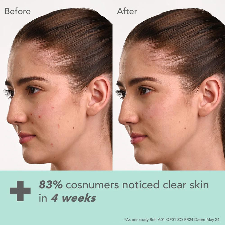 Lotus DermaBotanics Kojic Acid + Multi Berry Ampoule Crème | Reduces Blemishes & Enhances Radiance | Made with Dermatologists, pH 5.5 | Non-irritating | Suitable for Sensitive Skin | 50g