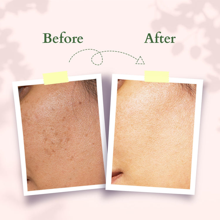 Lotus Organics+ Precious Brightening Serum + Cream | 100% Organic White Peony | Sulphate & Paraben Free | All Skin Types | 30g