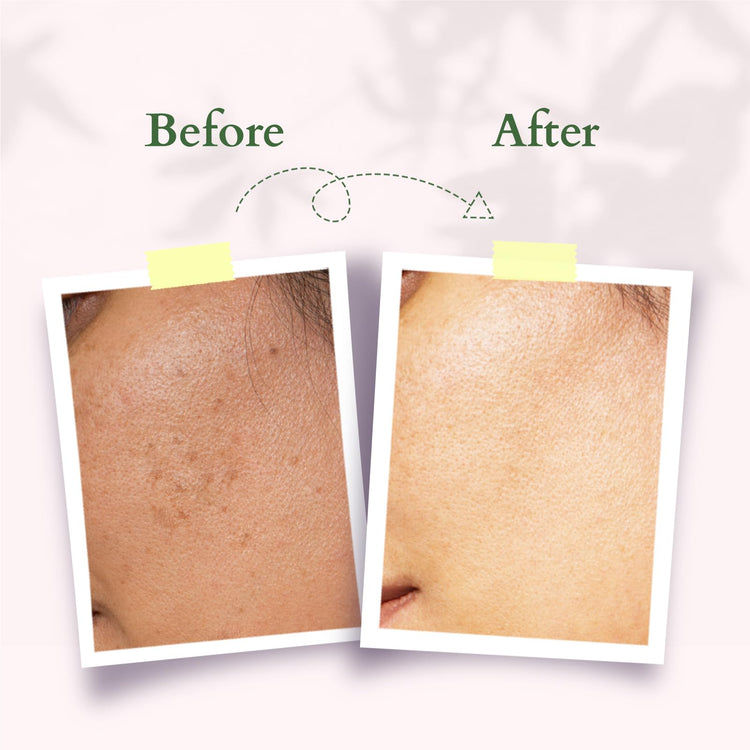 Lotus Organics+ Precious Brightening Face Exfoliator | Gentle and Effective Organic Face Scrub | 50g